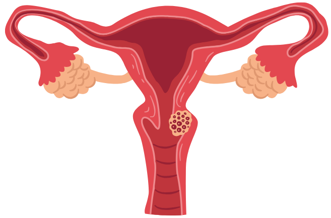 anatomy of a uters: Ovaries and fallopian tubes, womb, cervix and vagina
