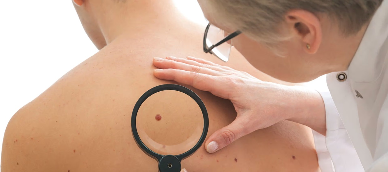 doctor looking at blemish on patient's hand.