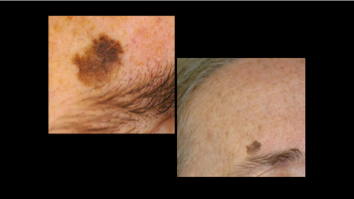 Evaluation of a Dermatology Patient