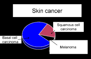 Malignant Neoplasms of the Skin