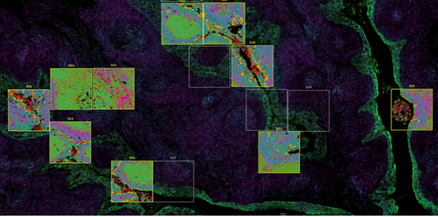 Cells characterization on the tissue digital image