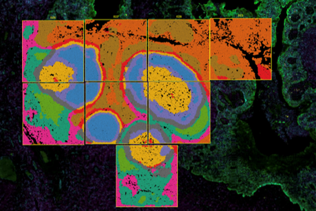 Neighborhood Analysis RNA based digital image