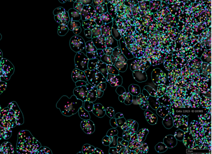 Single transcript view and cell segmentation marker based digital image