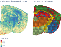 Visium whole transcirptome and visium spot clusters digital images