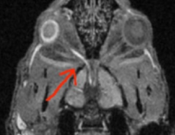 Axonal transport of Mn