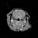 DEC MRI mouse brain tumor