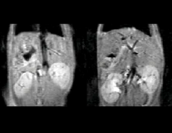 Gd-Based Renal Function