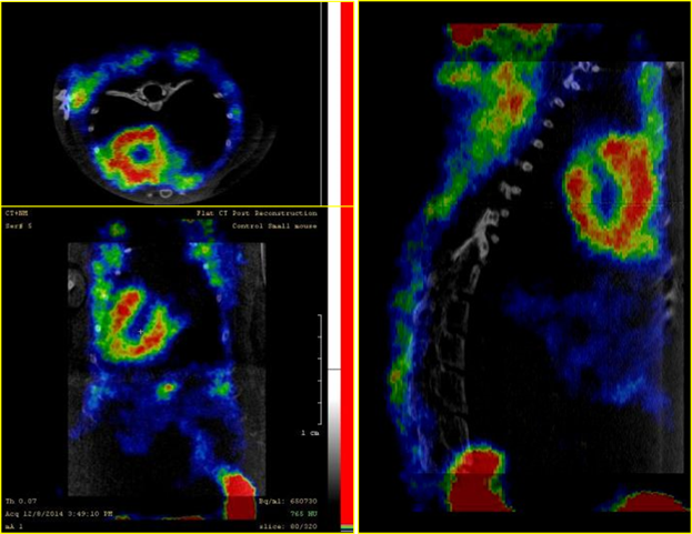 Normal Myocardium