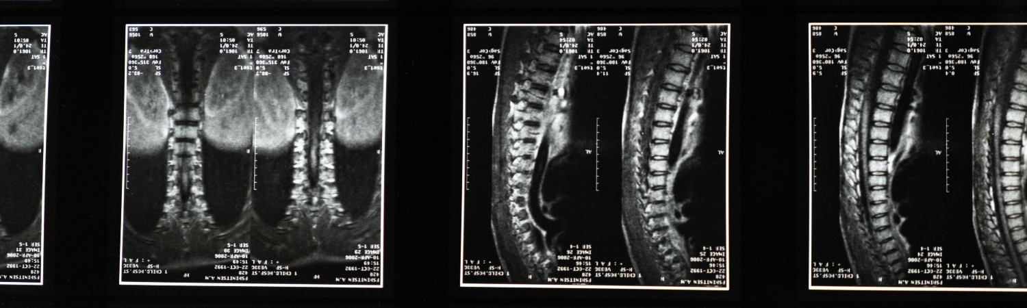 SMALL ANIMAL IMAGING