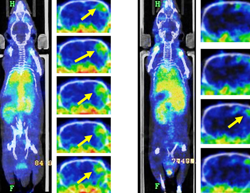 Tracking Exosomes in Stroke