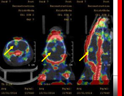 Tracking Macrophages in Stroke