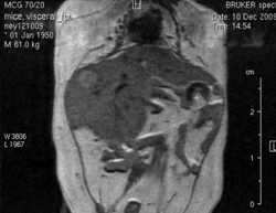 Visceral Fat Segmentation