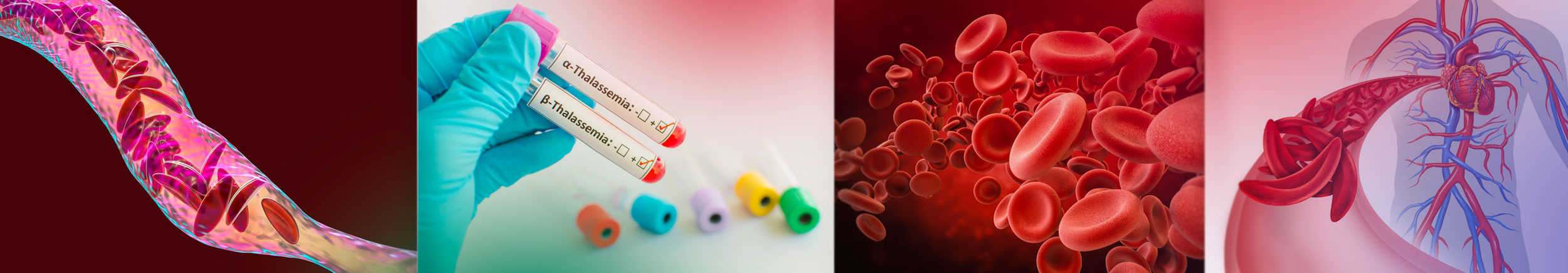 rendered images of blood disorders
