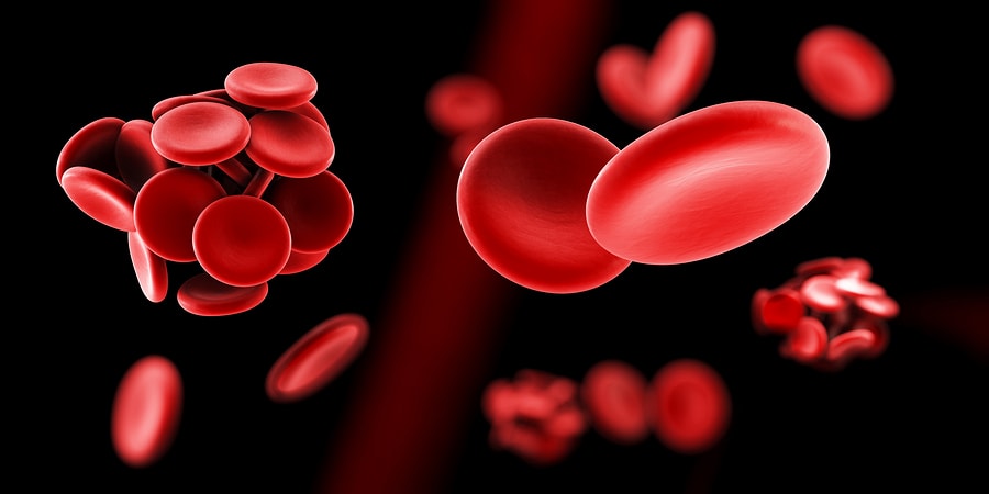 thrombophilia image
