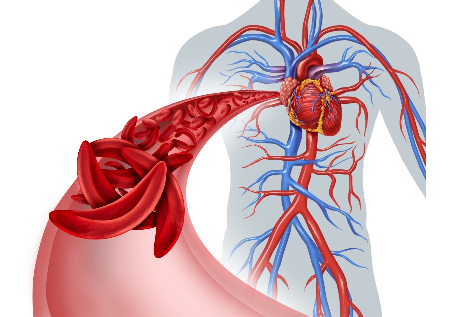 vein and sickle cell drawing