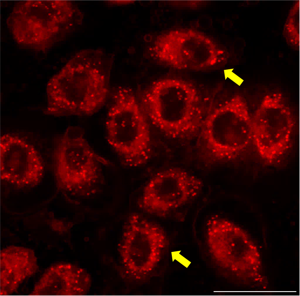 Nile red staining Nile red staining