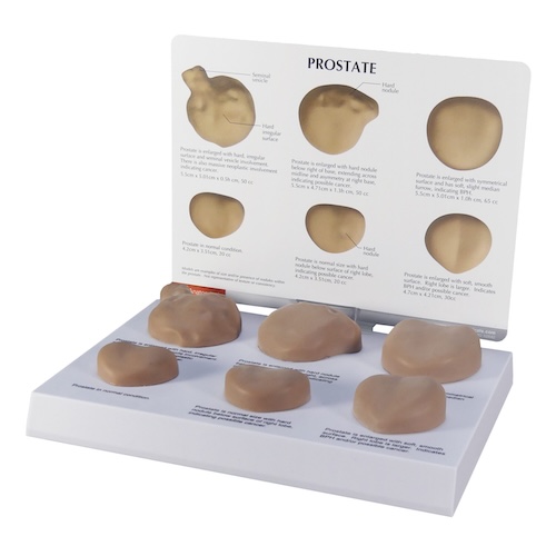 GI/GU by Prostate Model for Teaching