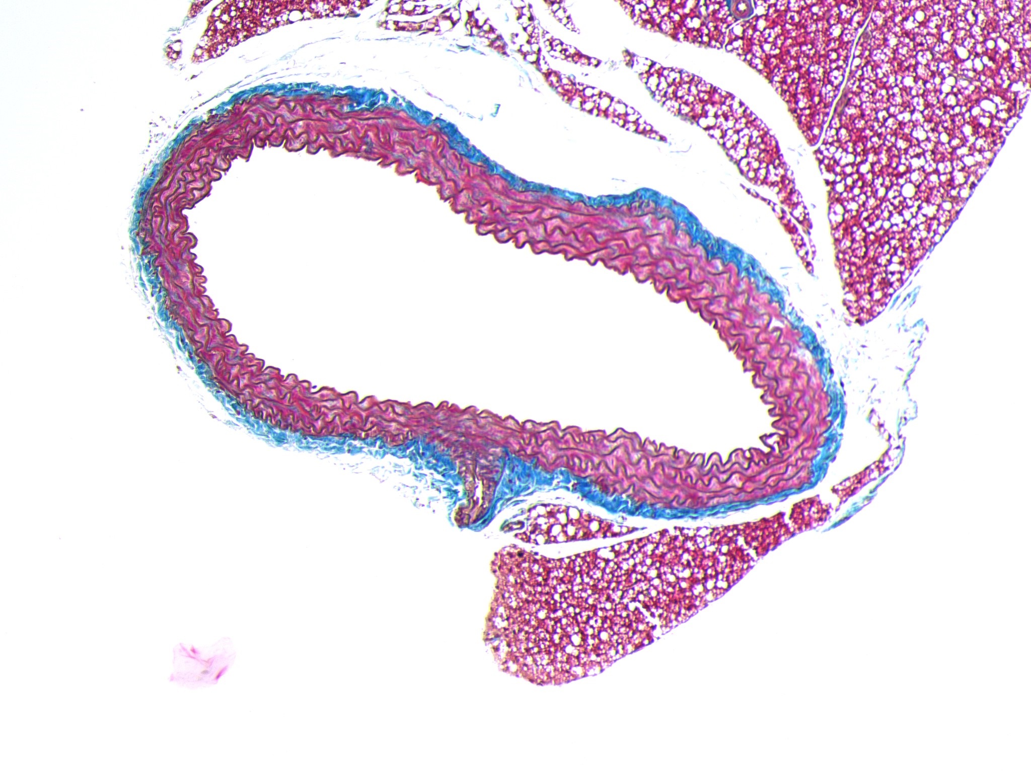 Aorta xxm Ogola research picture