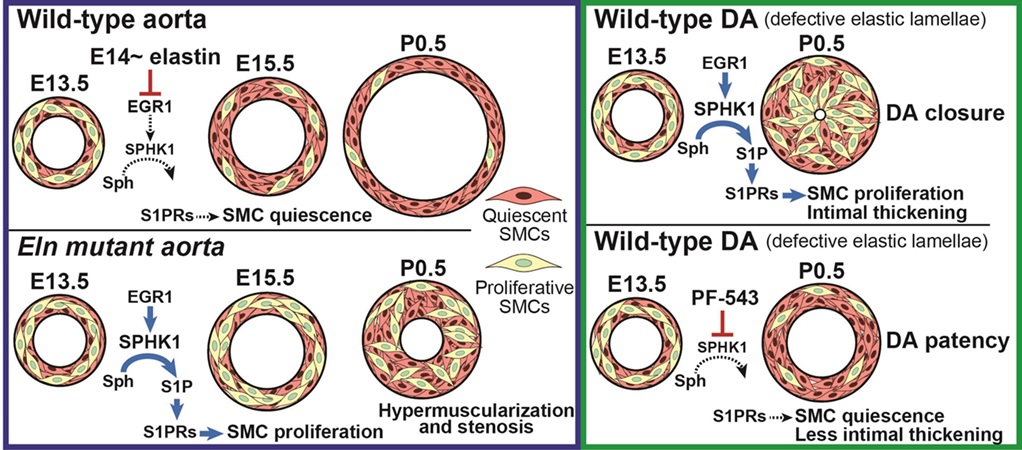 Figure 3. Sphingosine kinase 1 is integral for elastin deficiency-induced arterial muscularization. Nat Cardiovas Res. 5(1):34-50. 2026.