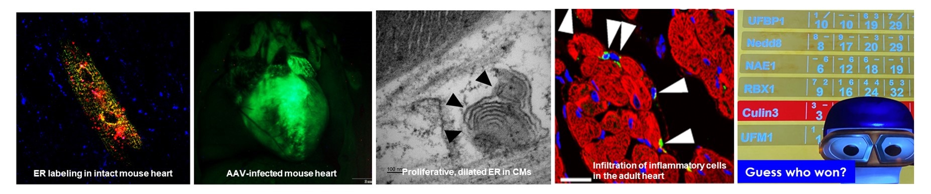 images of: ER Labeling in intact mouse heart, AAV- infected mouse heart, Proliferative, dialted ER in CMs, infiltration of inflammatory cells in the adult heart, cartoon in lab gear with dialogue saying ' Guess who won?'