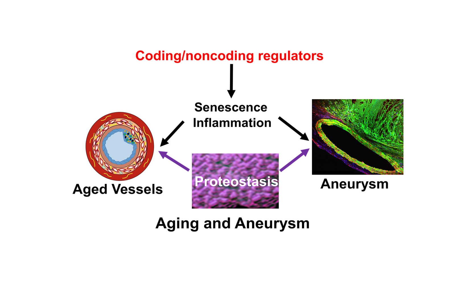 Aging and Aneurysm - Coding/noncoding regulators to senescence inflamation and proteostasis to aneurysm or aged vessels. 