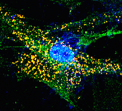 Role of lncRNAs in the regulation of VSMC phenotype and vascular disease