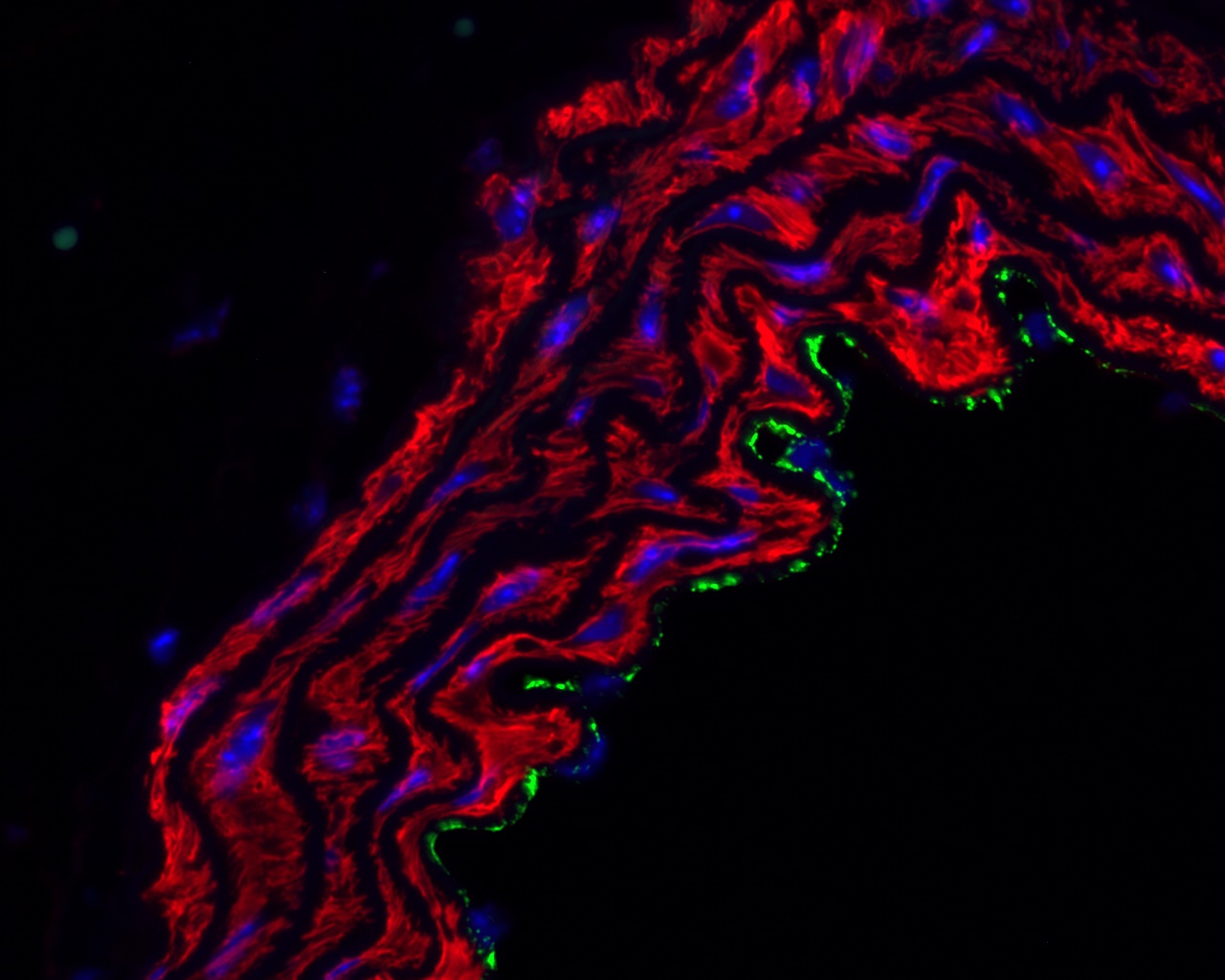 VWF a Actin merged Ogola research picture