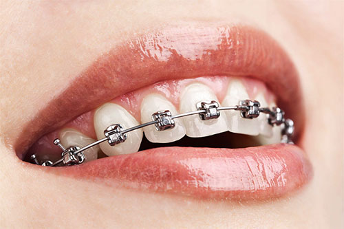 Advanced Education Program in Orthodontics