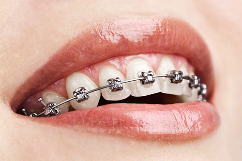 Orthodontics