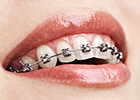 Thumbnail: Orthodontics