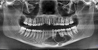 Cone Beam CT