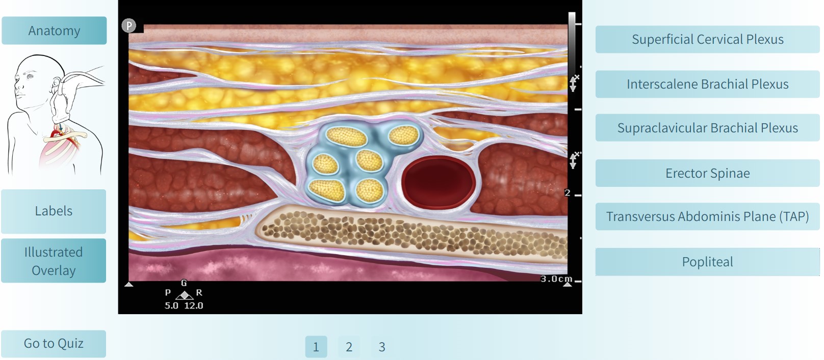 nerveblockpocus