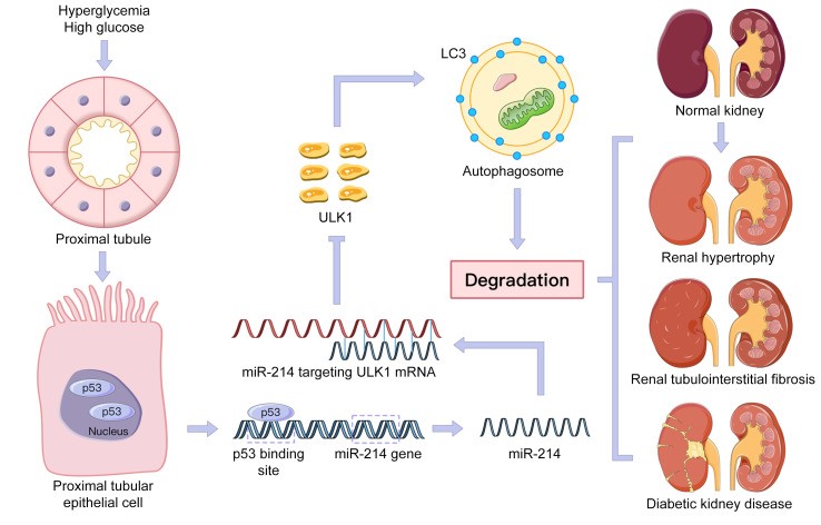 Axis impairs renal tubular autophagy in Diabetic Kidney Disease JCI