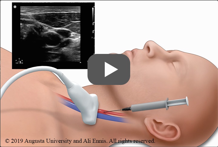 Image of face ultrasound - Copyright Augusta University and Ali Ennis. All rights reserved. 