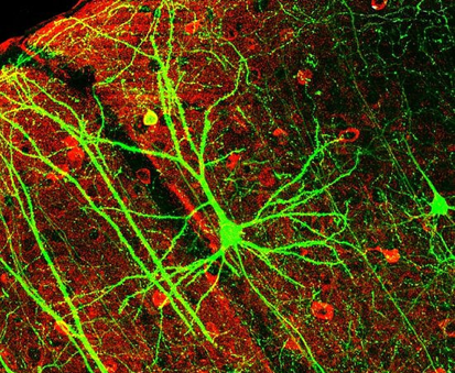 Neural Plasticity and Auditory Learning