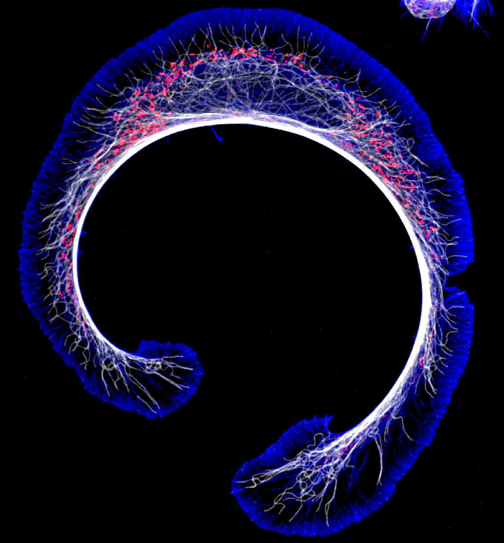 Dr. Vitriol lab image deconvolved d5 iterations type blind snapshots