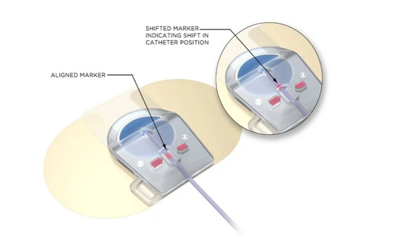 medical device image