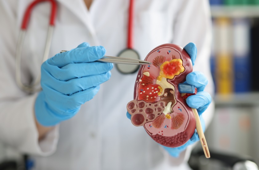 doctor pointing to model kidney