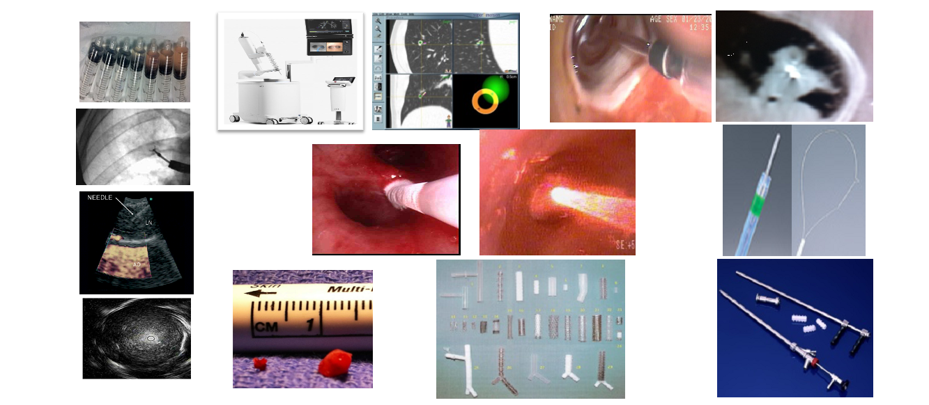 Advanced Airway Techniques