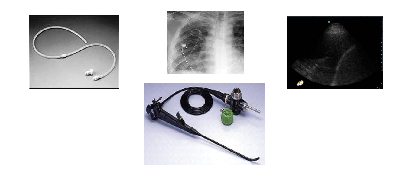 Pleural Disease Techniques