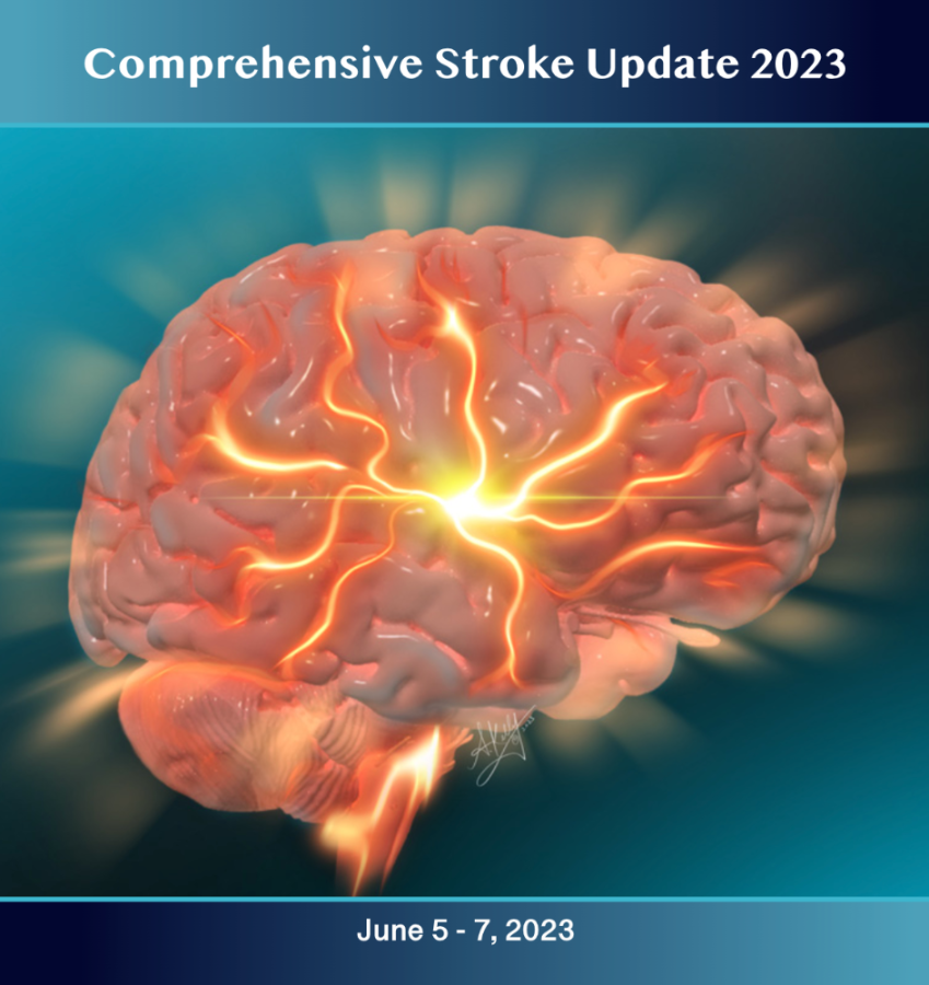 Comprehensive stroke update 2023