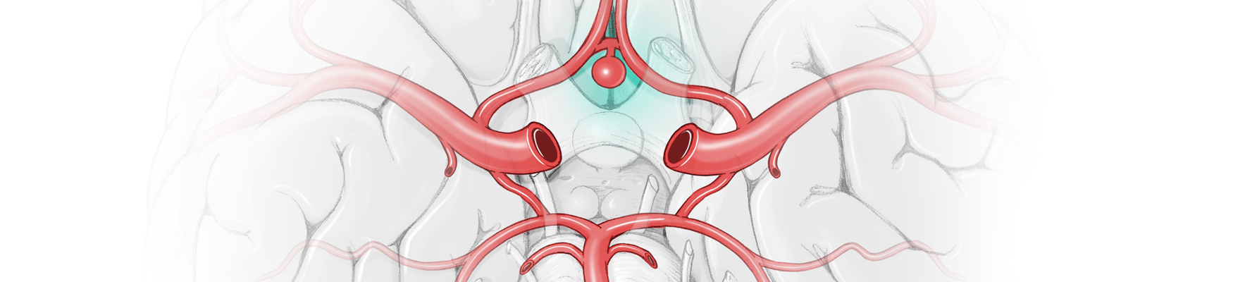 Neurosurgery