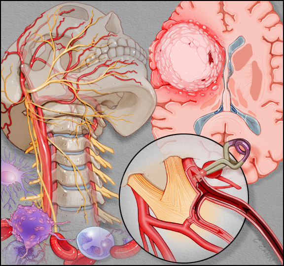 neuro brain image