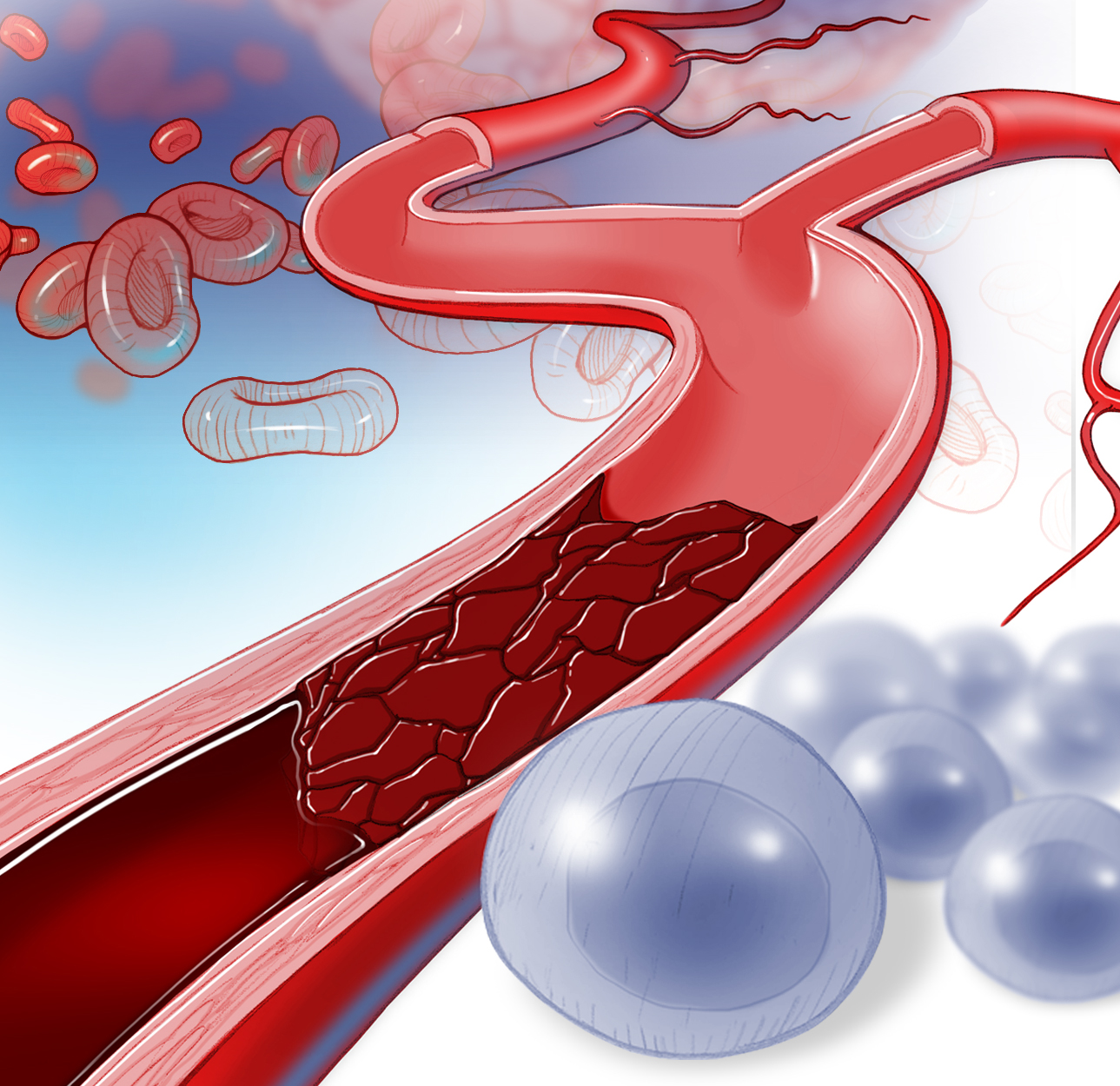 stroke stem cells