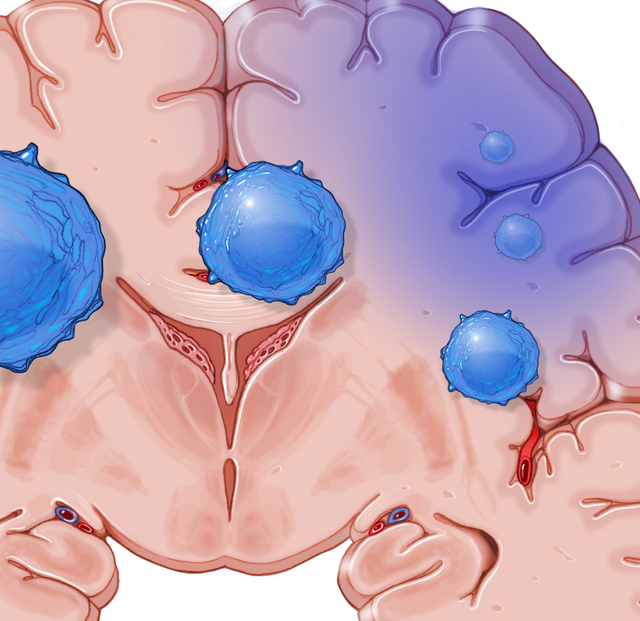 tbi lymph cells