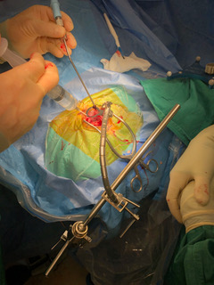 surgical image