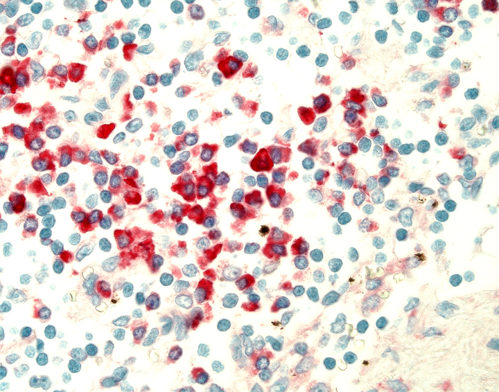 Alkaline Phosphatase detection" human lymph node