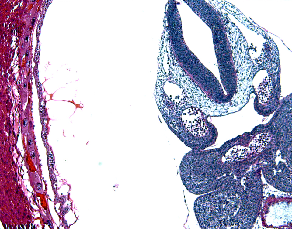 Hematoxylin and Eosin Stain, mouse embryo