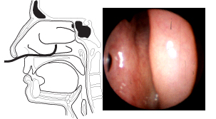 Figure 3a