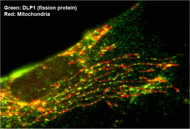 Photo of Dr. Yoon's research of mitochondria